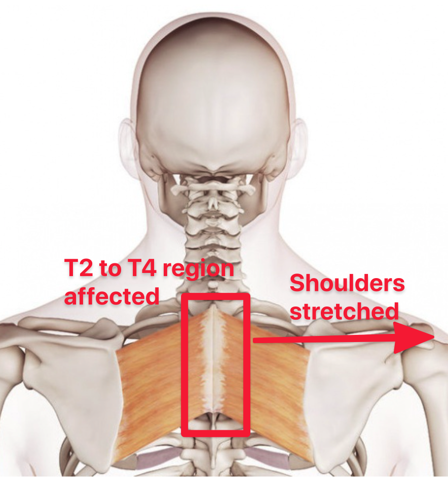 T2 to T4 gets pulled because the wrists are pulled.